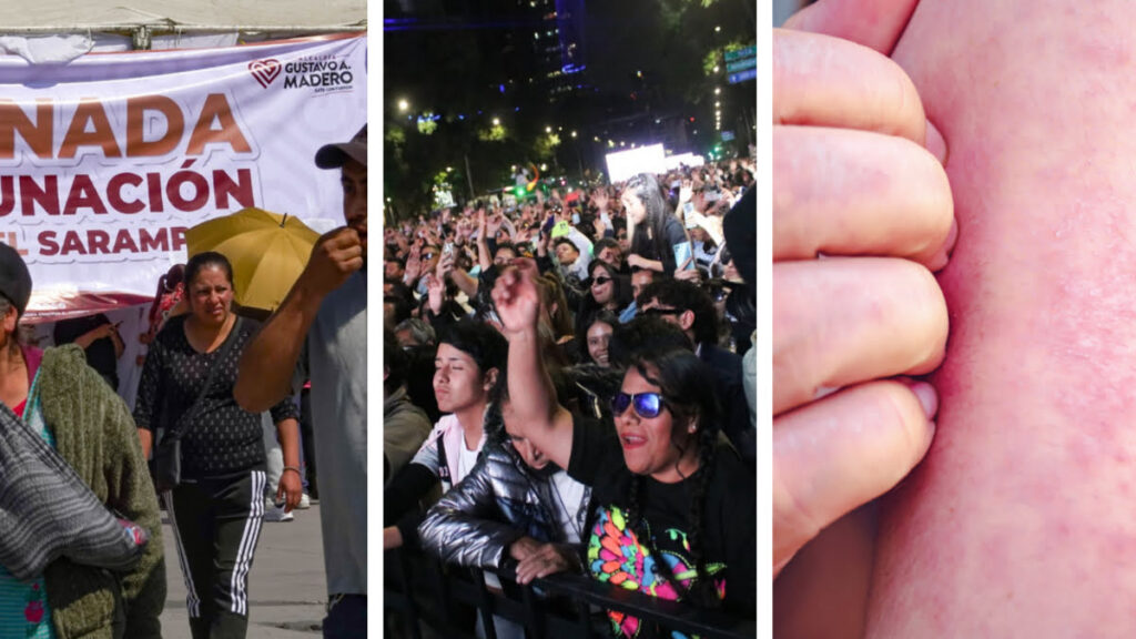 Suspenden eventos masivos por sarampión en estados.