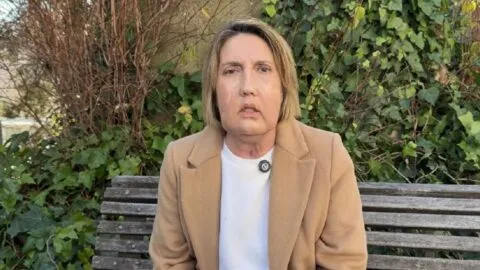 Realizan primer trasplante parcial de cara con donante tras eutanasia en el mundo