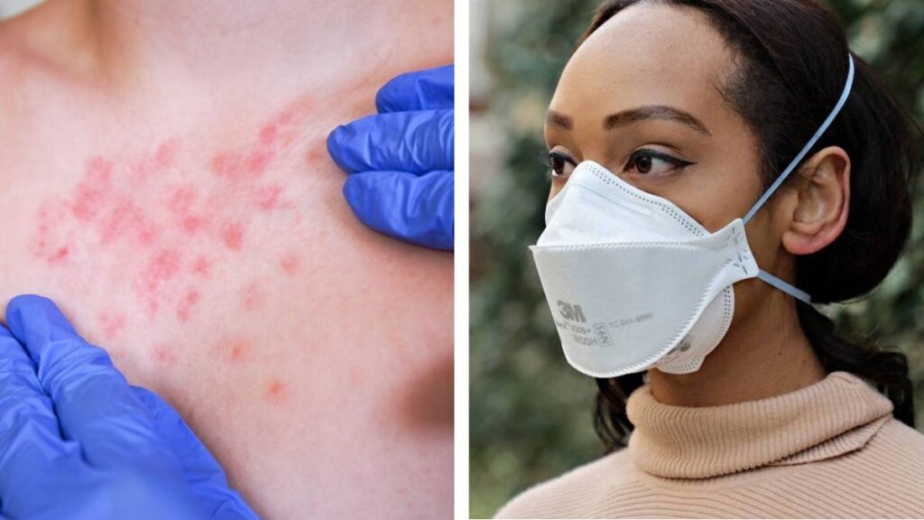 Estados donde recomiendan uso de cubrebocas por brote de sarampión; experto analiza su eficacia