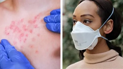 Estados donde recomiendan uso de cubrebocas por brote de sarampión; experto analiza su eficacia