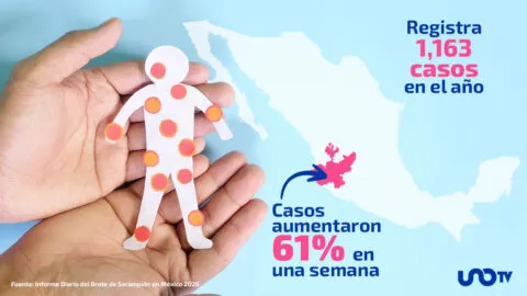 Jalisco es el nuevo "epicentro" del sarampión en México: tiene el 58% de los casos en 2026