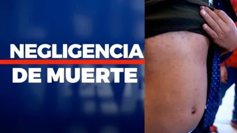 "Será Viral": Contagios de sarampión son una amenaza rumbo al mundial