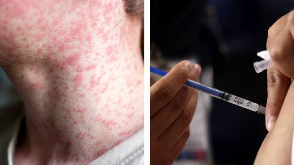 Personas de 6 meses a 49 años pueden vacunarse