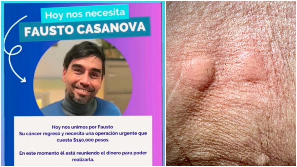 Actor de "La Rosa de Guadalupe" enfrenta agresivo cáncer y pide ayuda para su tratamiento