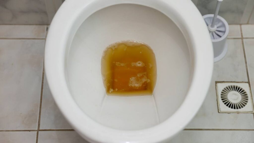 La espuma en la orina puede ser normal