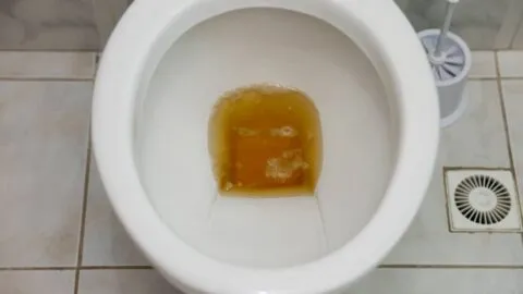 Orina espumosa: lo que debes saber de tu salud y qué alimentos pueden ayudar a los riñones