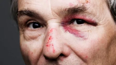 Video: presidente de condominio golpea a abuelito en Cholula