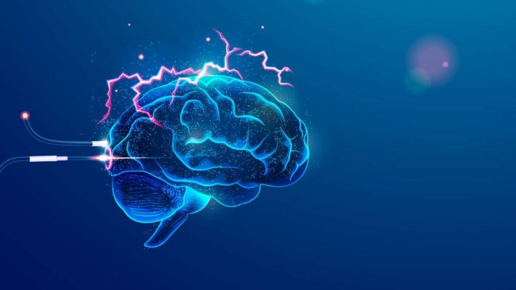 Cerebro