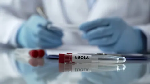 ¿Quién es y qué pasará con Peter Stafford, médico estadounidense expuesto al ébola en África?