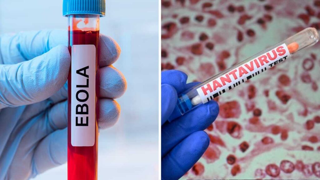Ébola y hantavirus encienden alertas mundiales; expertos advierten riesgos