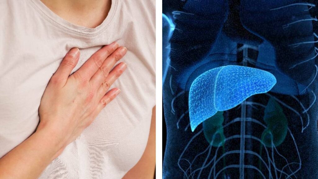 La enfermedad hepática grasa debe tratarse para evitar un infarto