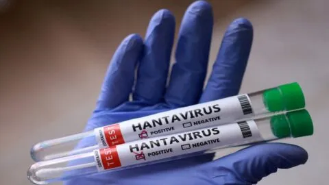Reino Unido detecta un tercer caso sospechoso de hantavirus; ¿qué se sabe del brote?