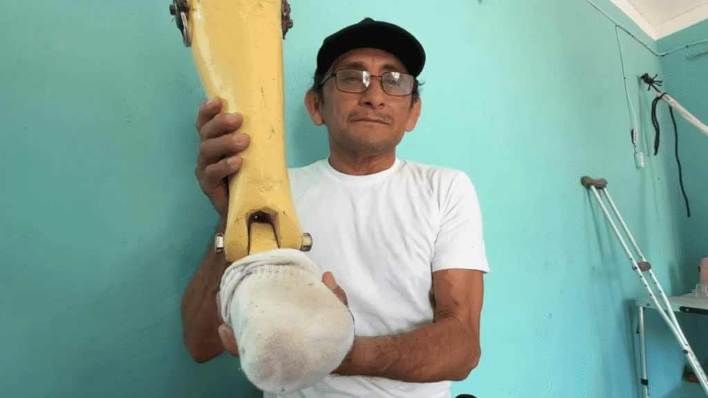 Pescador crea prótesis