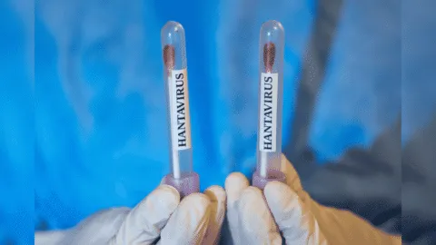 OMS descarta riesgo alto por brote de hantavirus: "no se trata de un nuevo Covid"