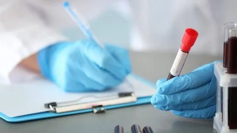 Un análisis de sangre podría detectar y medir el avance del Alzheimer