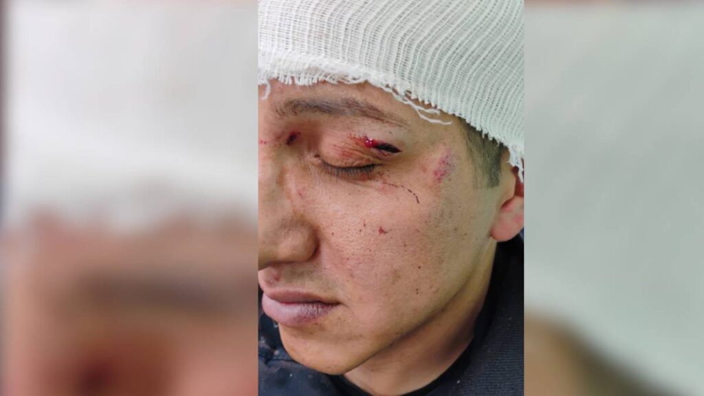 Policía herido tras protesta en Conalep.
