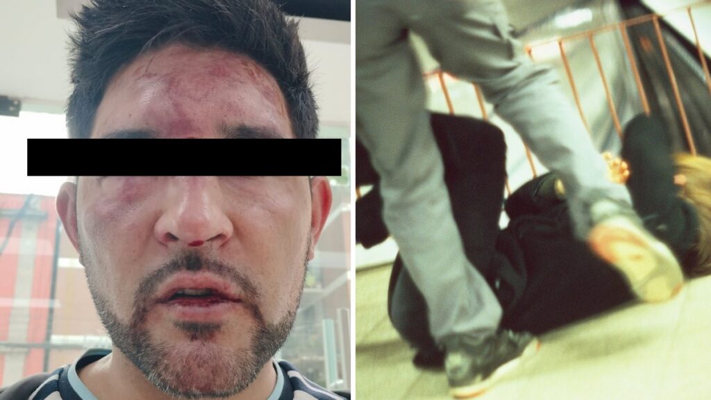 Golpiza deja hospitalizado a aficionado argentino. Foto: Uno TV/Getty