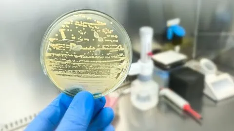 UNAM alerta: bacteria resistente a antibióticos está presente en animales, plantas y alimentos