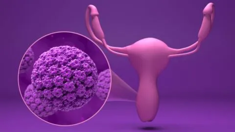 ¿Antioxidantes contra el cáncer de cuello uterino? Estudio encuentra una posible relación