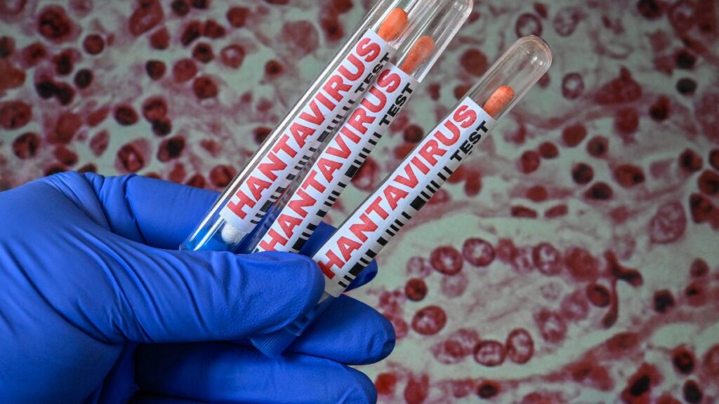 El turista con hantavirus reside habitualmente en Argentina