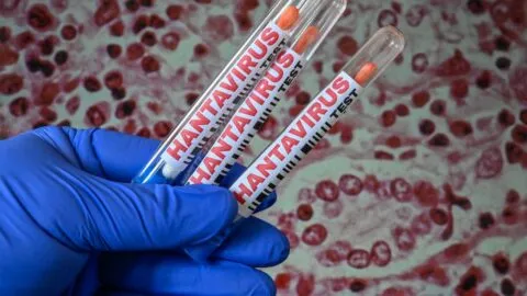 Detectan en Francia un contagio de hantavirus Andes; paciente fue aislado en España