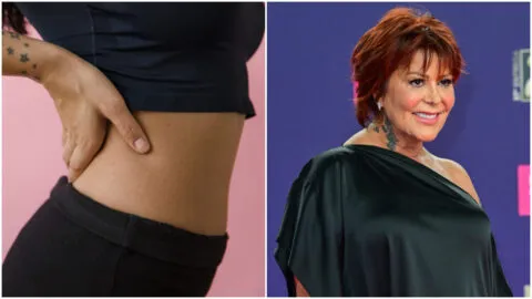 ¿Qué es la luxación de cadera y por qué sucede la lesión que sufrió Alejandra Guzmán?