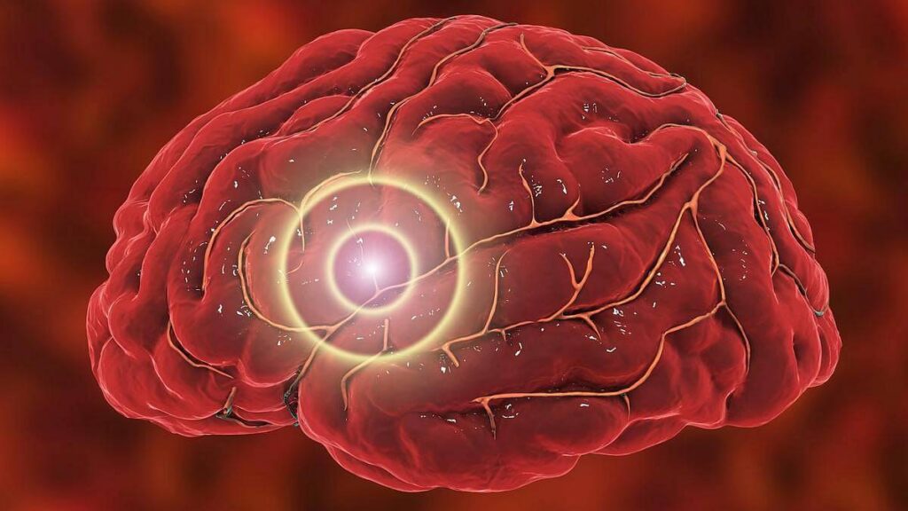 Cerebro