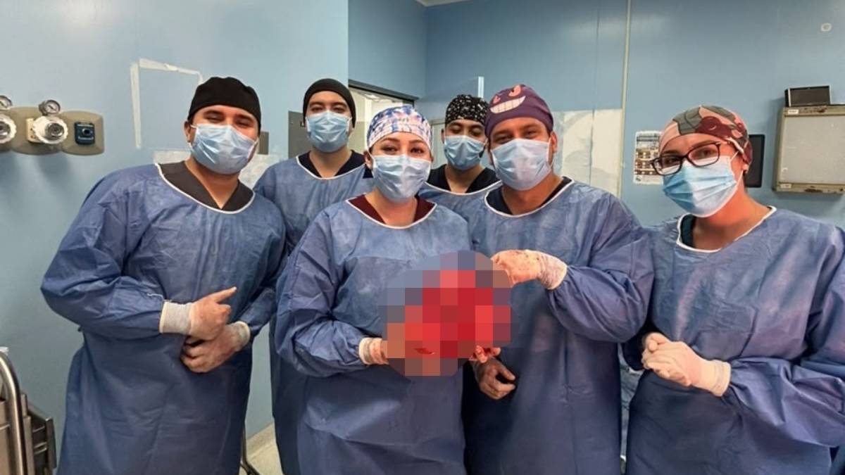 Un reto médico: especialistas del ISSSTE lograron extirpar un tumor de 4 kilos a paciente de Baja California Sur