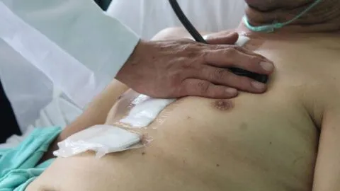OCDE: México registra más muertes por causas prevenibles