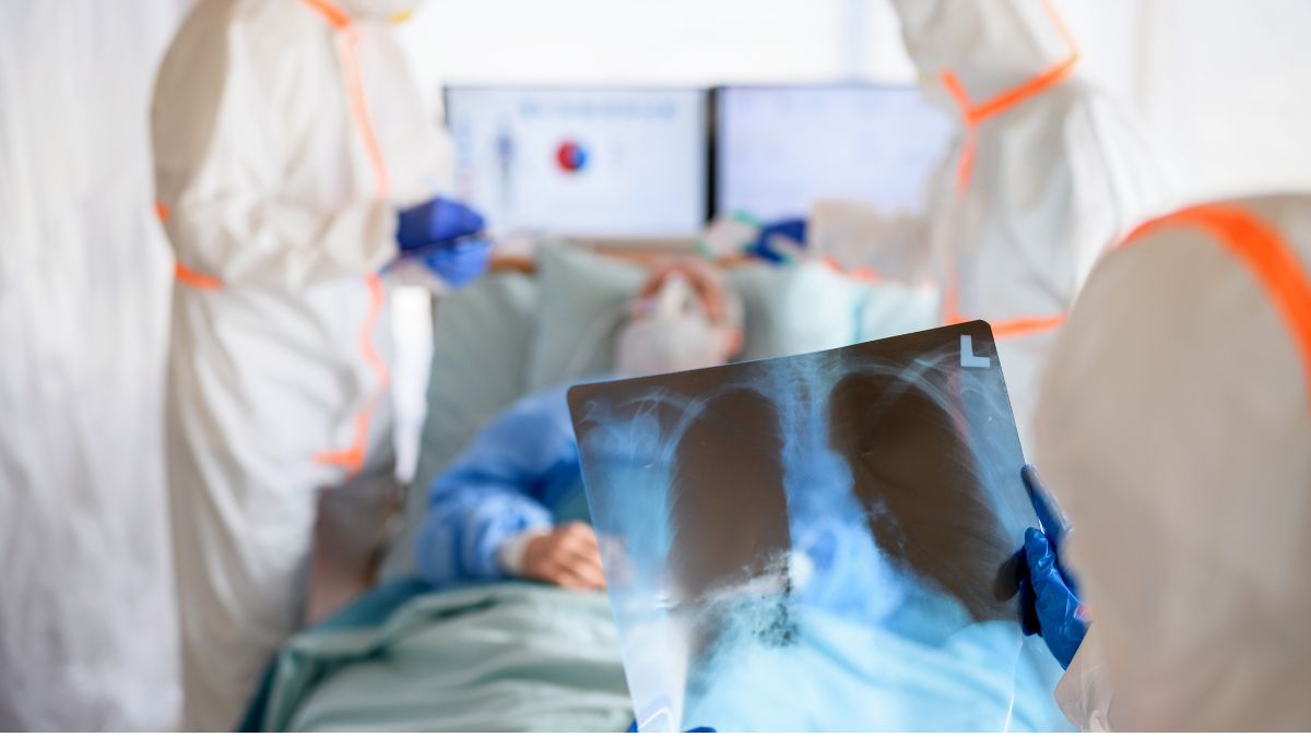 Alerta por peste neumónica: 5 datos que debes conocer antes de preocuparte si estás en Estados Unidos