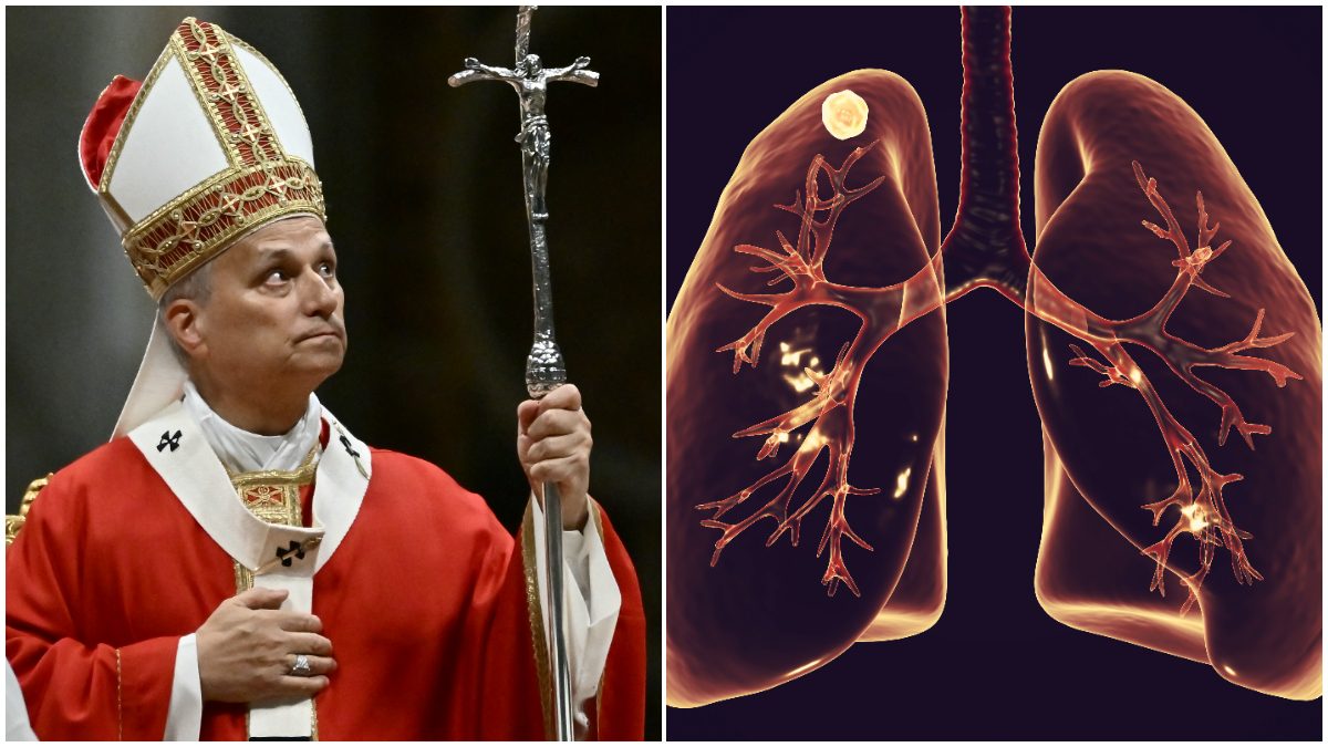 ¿Qué es un nódulo pulmonar, la afección por la que operarán al Papa León XIV?