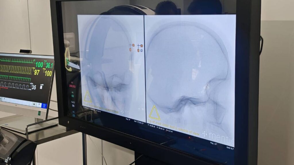Simulación de un infarto cerebral en el Centro Médico ABC.